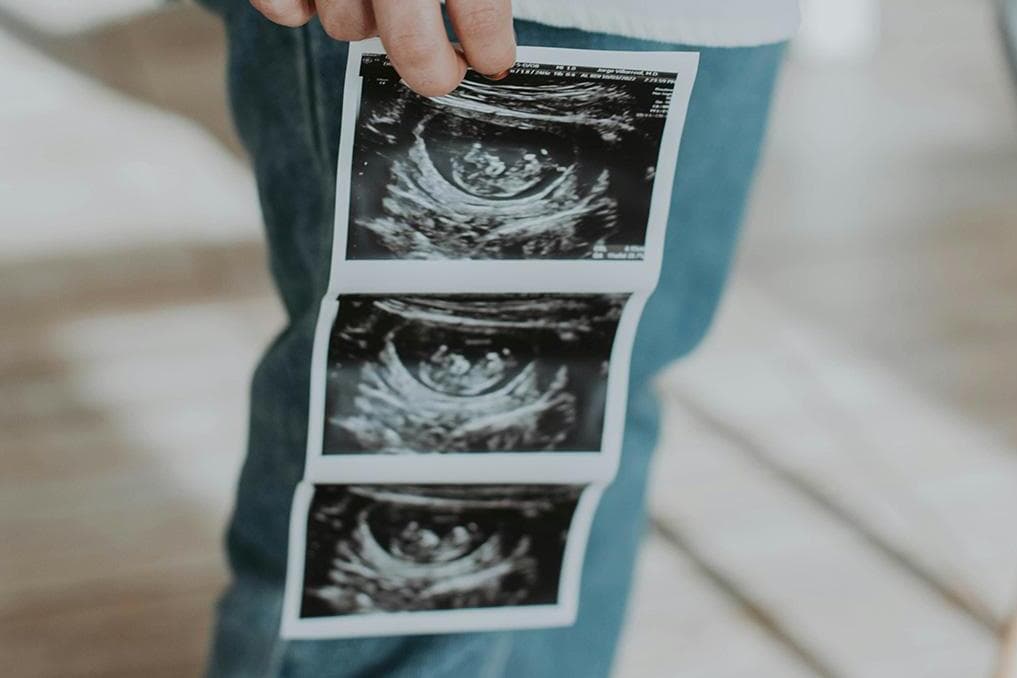 Texas dad sues out-of-state doctor for abortions of his 2 children