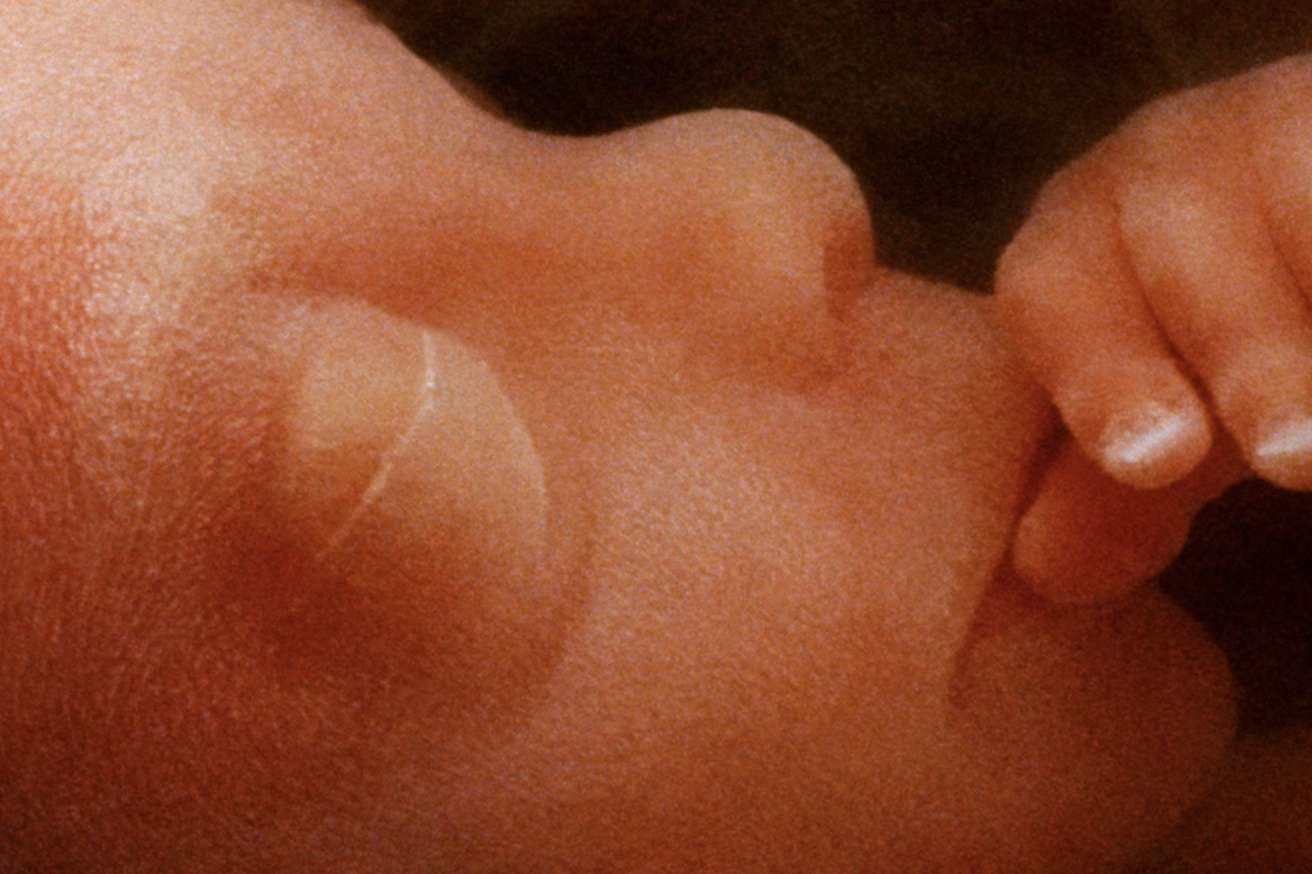 Can't make it to DC? Join online witness proclaiming humanity of pre-born instead