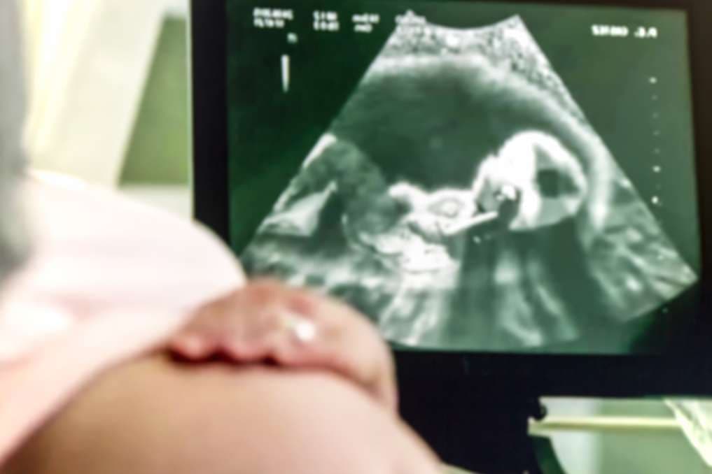 Several students try to disturb pro-life display at Yale