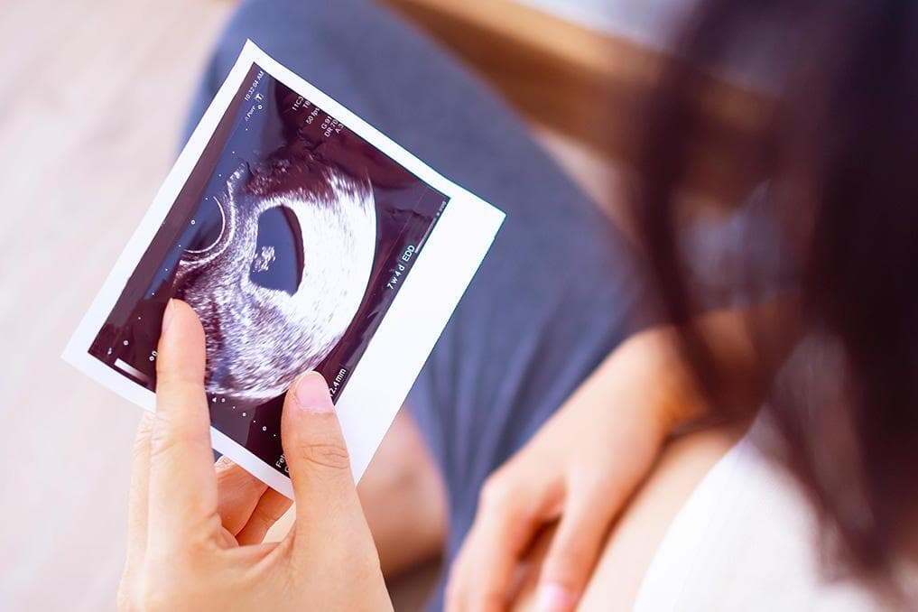 Pro-life lawsuit calling Minnesota’s abortion laws coercive heard in federal court