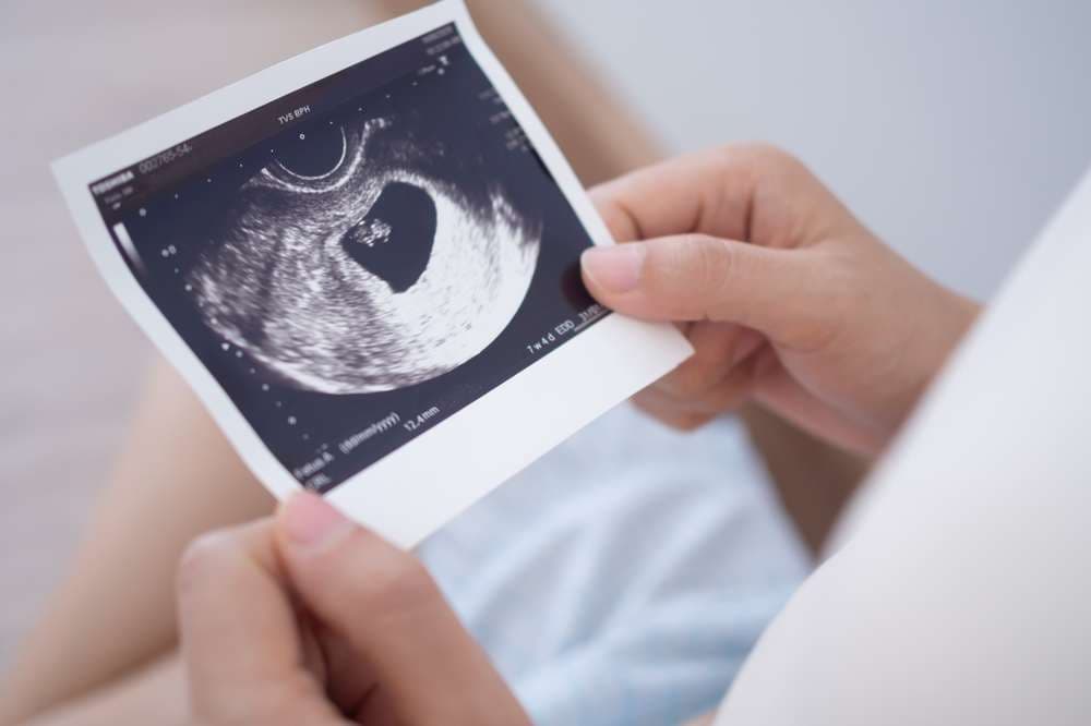 Survey finds US more pro-abortion than in 2020 but open to reducing abortions