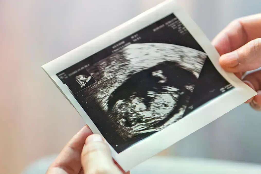Prince Albert of Monaco rules out legalizing abortion, citing country’s Catholic identity