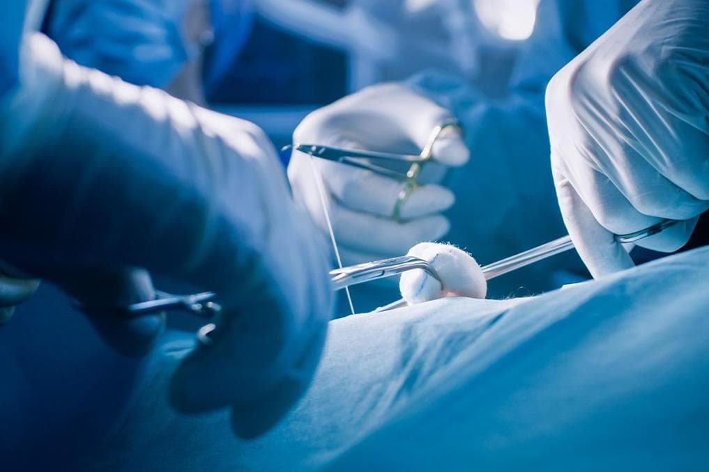 Appeals court rules insurance policies don’t need to cover ‘transgender’ procedures