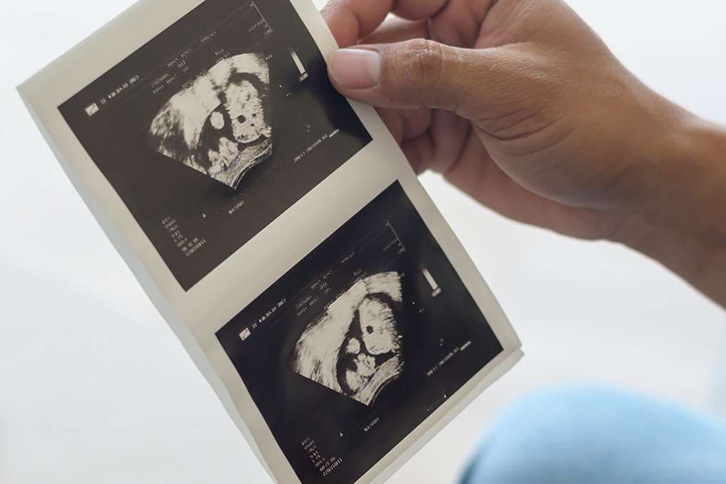 Annual pro-life essay contest receives triple number of usual submissions
