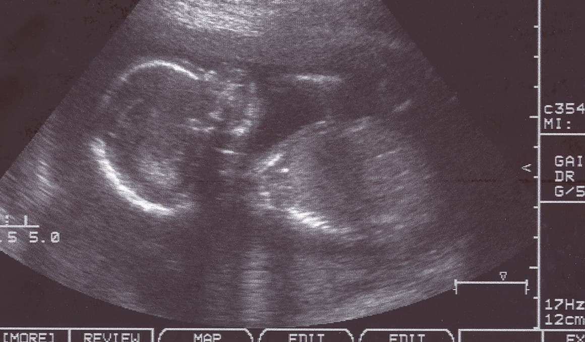 Washington state Democrats pass bill making it harder to investigate infanticide
